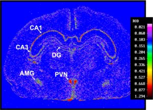 Expression of glucocorticoid receptors in a cross section of the fetal guinea pig brain in late gestation. Hippocampus (CA1, CA3), dentate gyrus (DG), amygdala (AMG) and paraventricular nucleus (PVN).