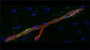 A microvessel in the developing fetal brain. Over 400 miles of microvessels make-up the blood-brain barrier (BBB) in the adult human brain. Red stain: Von Willibrand factor (positive stain for endothelial cells), Green stain: P-glycoprotein (P-gp), Blue stain: nuclei.
